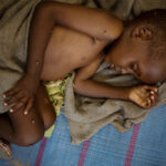 malnutrition diseases